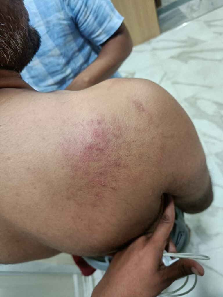 కొల్లాపూర్ లో జూపల్లి అనుచరుల వీరంగం