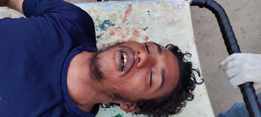 A young man drowned in Zoom swimming pool and died