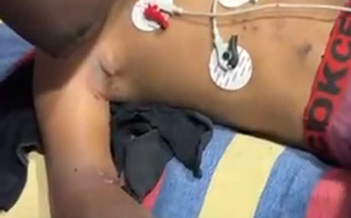 Boy seriously injured after receiving electric shock