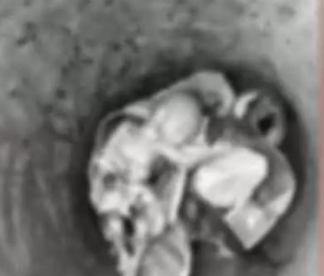 The body of a newborn baby in a bus stand bathroom caused a stir.