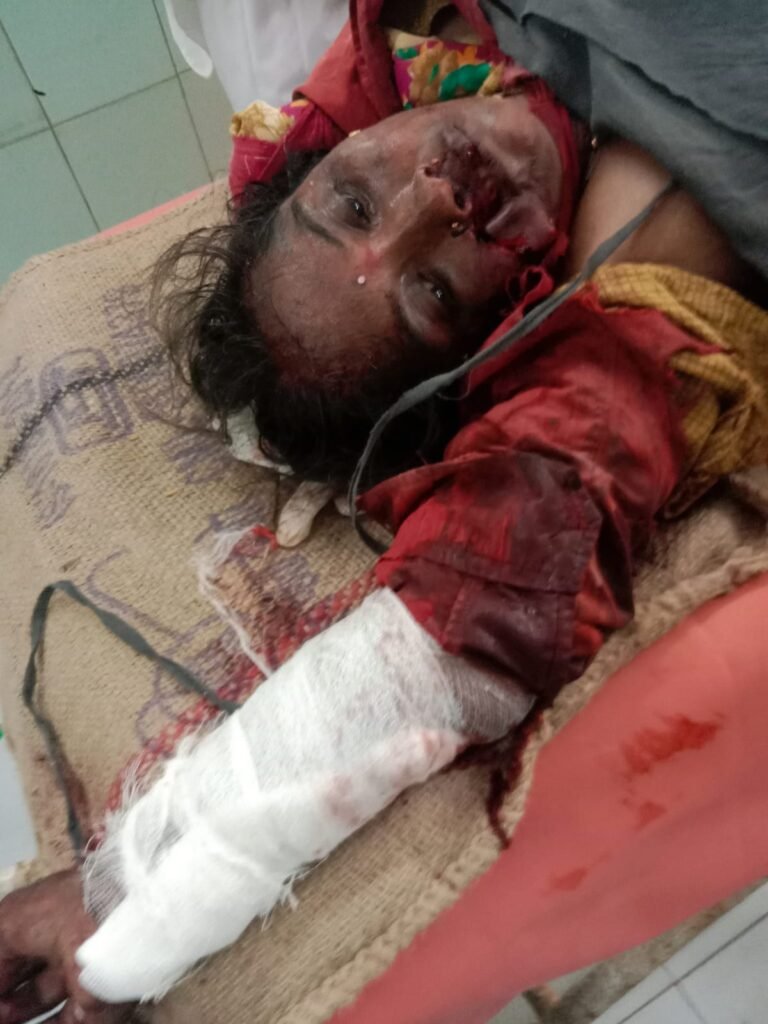 కిసాన్ ఆగ్రో ఇండస్ట్రీస్ రైస్ మిల్లులో మహిళకు తీవ్ర గాయాలు