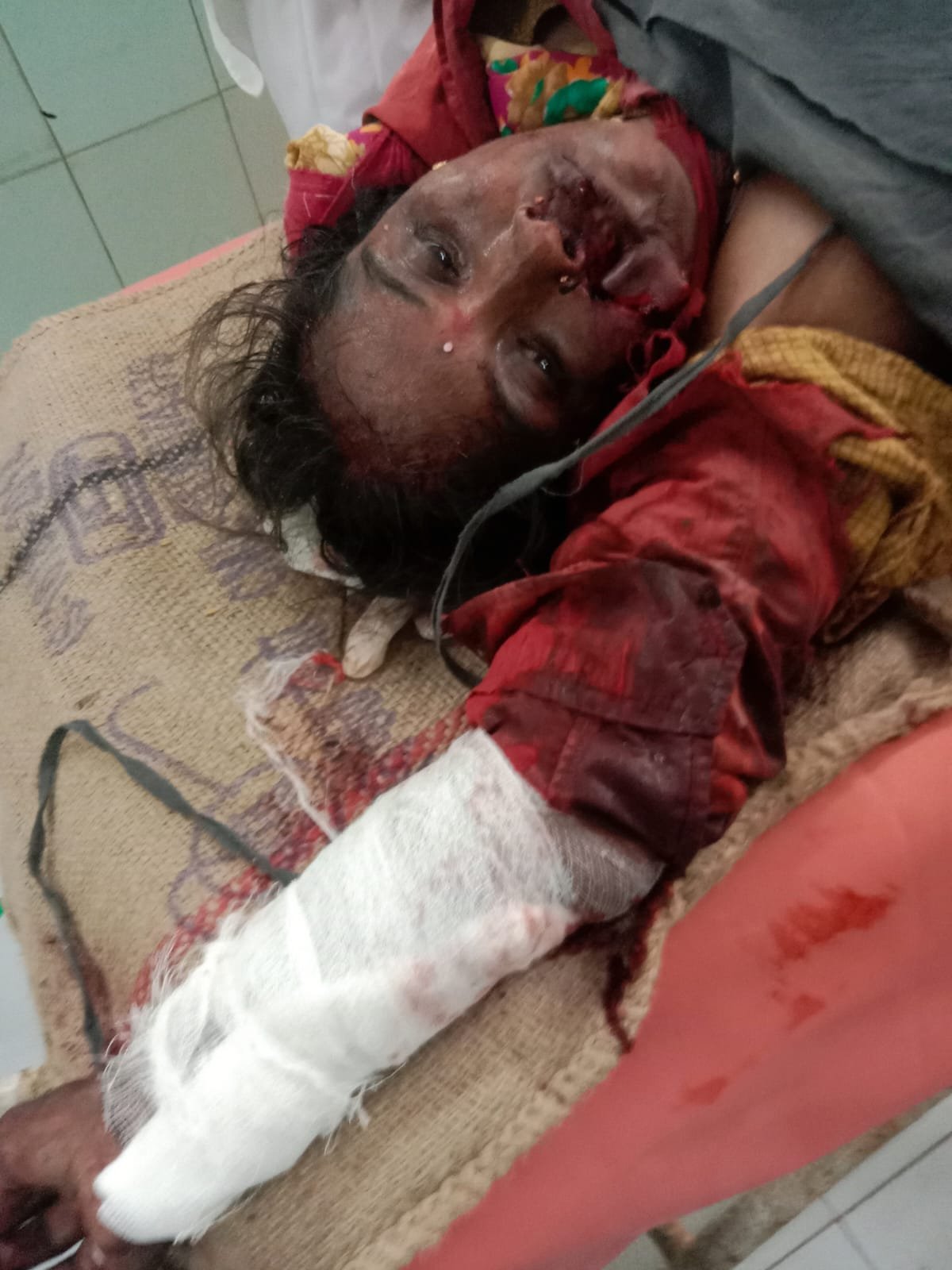Woman seriously injured in Kisan Agro Industries rice mill