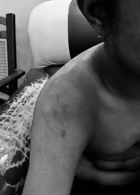 Student attacked at Sri Chaitanya School