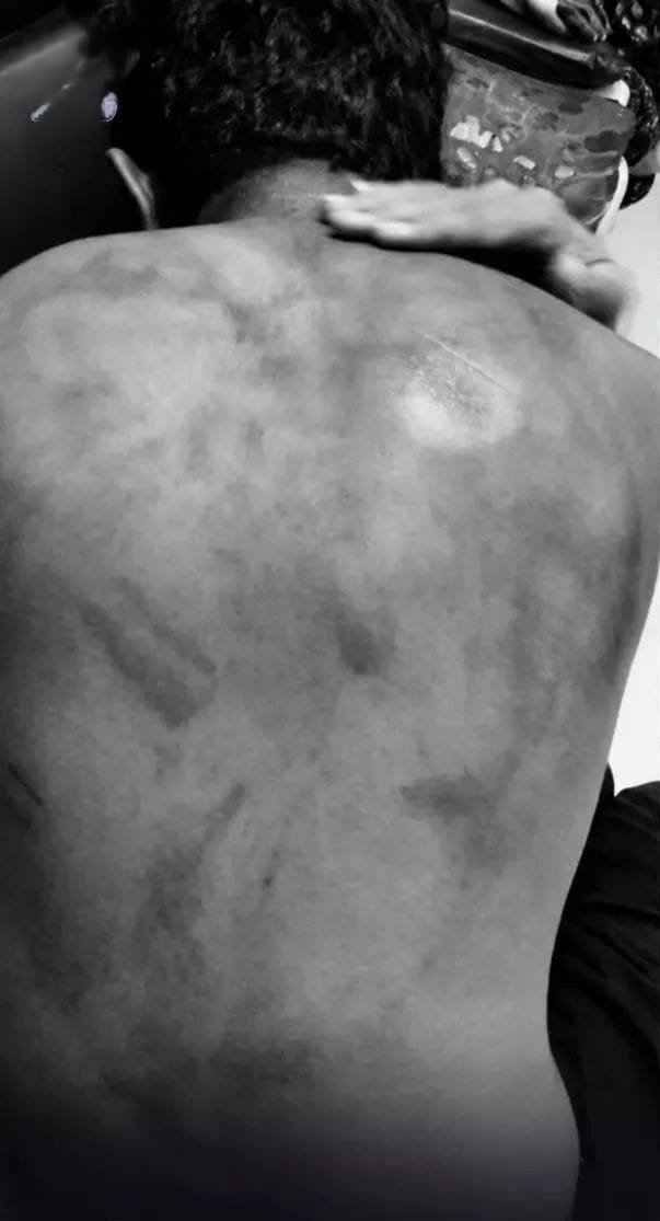 Student attacked at Sri Chaitanya School