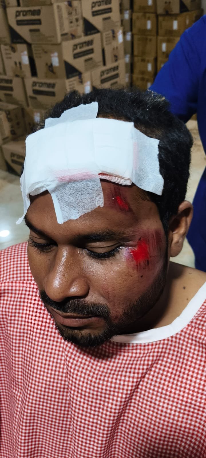 Youth sustains severe injuries due to short circuit.
