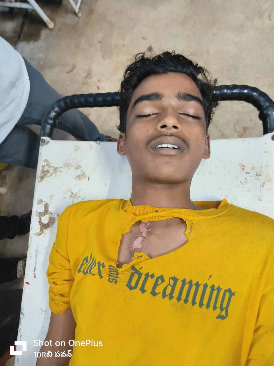Student dies after being struck by lightning