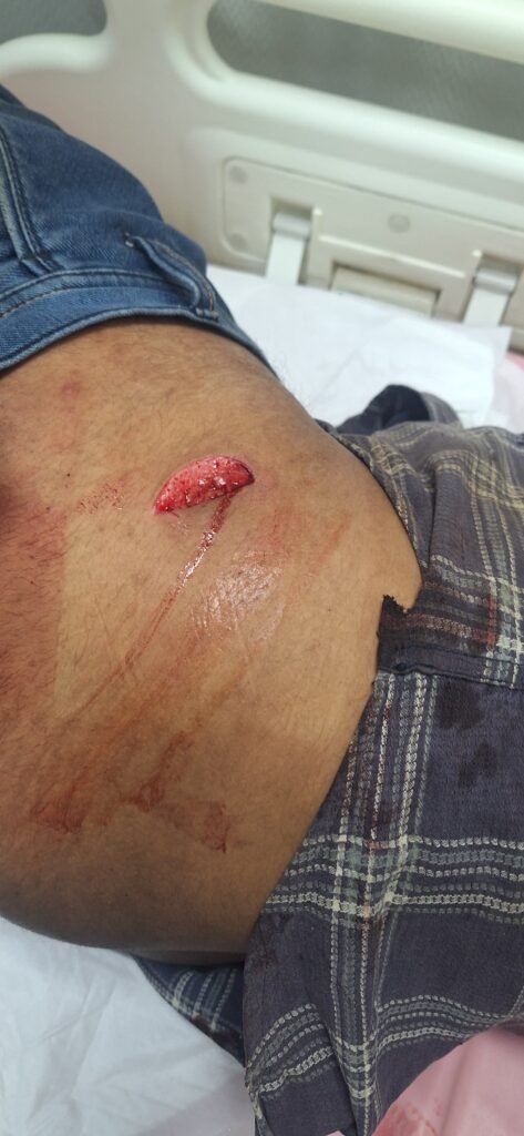 పాత కక్షలతో యువకుడిపై కత్తితో దాడి
